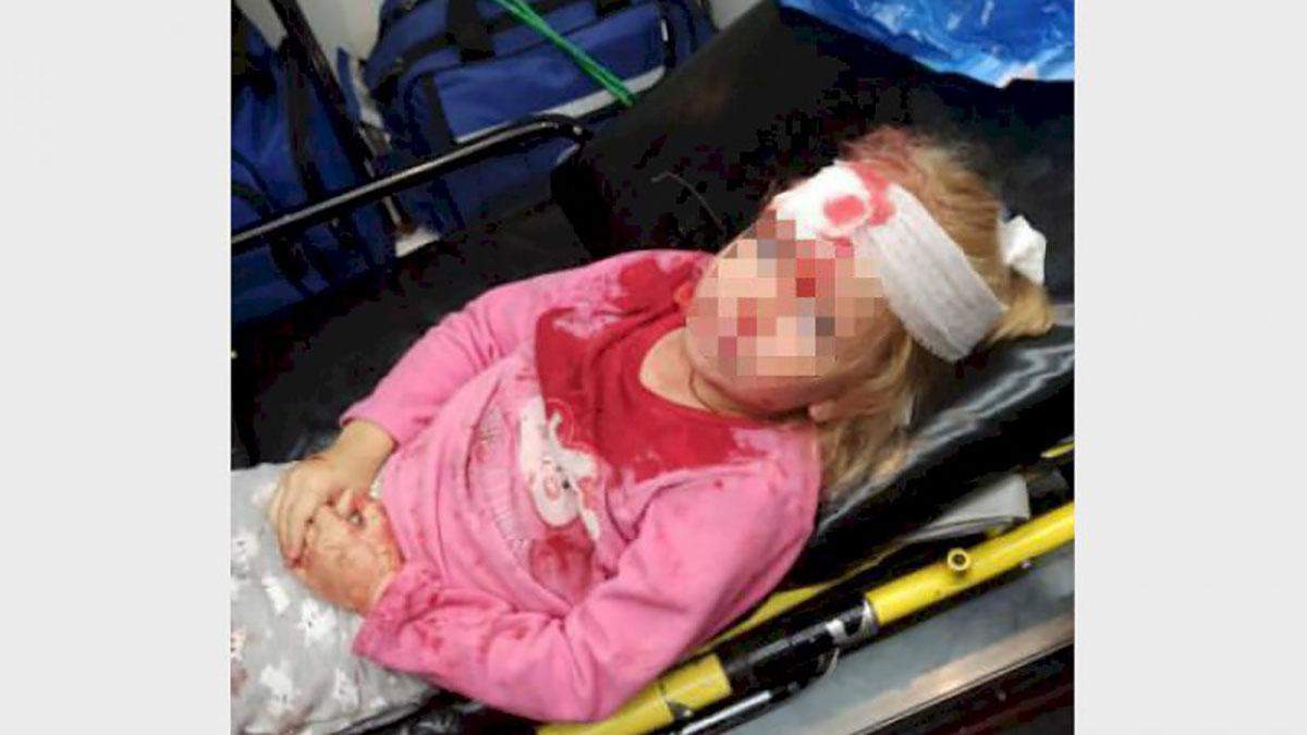 Постраждала дівчинка, яку збив військовий автомобіль у Гродно Постраждала дівчинка, яку збив військовий автомобіль у Гродно