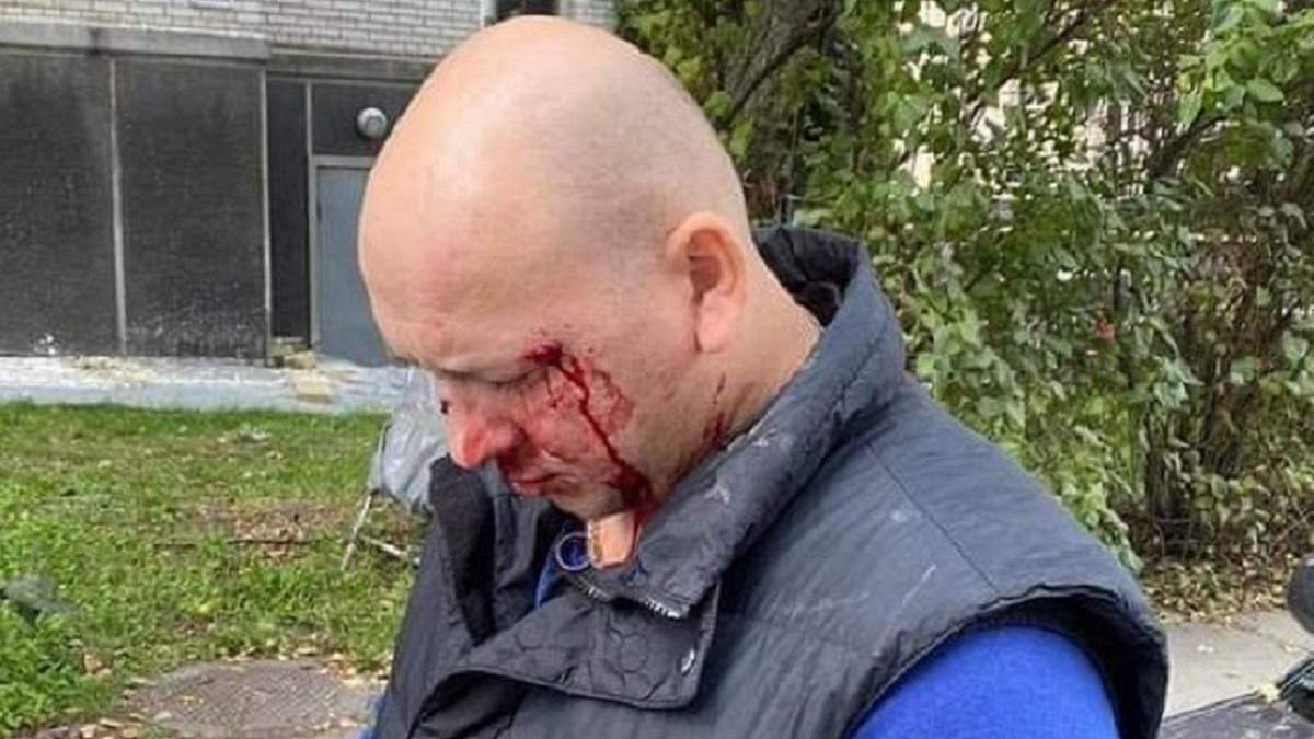 Побиття Івана Деєва в Києві: що відомо про нападників на ветерана АТО Побиття Івана Деєва в Києві: що відомо про нападників на ветерана АТО